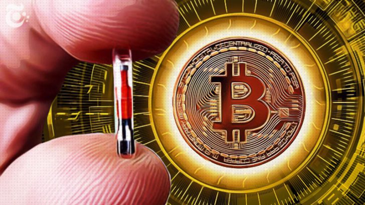 ビットコインを「体内マイクロチップ」に保管｜新時代の資産管理方法となるのか？